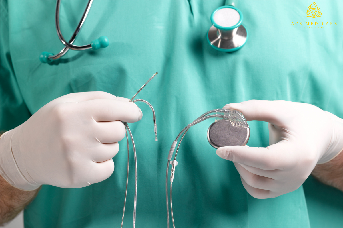 The Comprehensive Guide to Pacemaker Surgery: Analyzing Risks, Benefits, and Essential Considerations